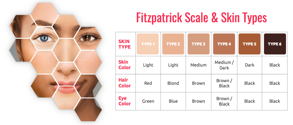 fitzpatrick scale